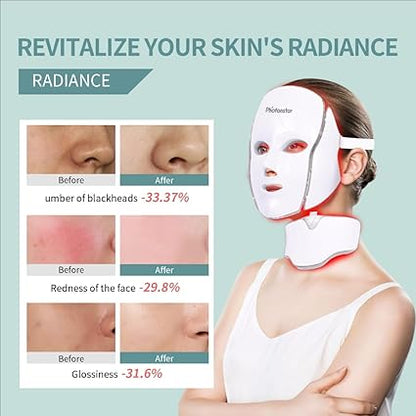 Before and after results of skin treatment using NexGen Face Mask Light Therapy, showing improved radiance and reduced blemishes.